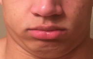 tyler1